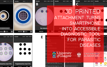 3D printed attachment turns smartphone into accessible diagnostic tool for parasitic diseases