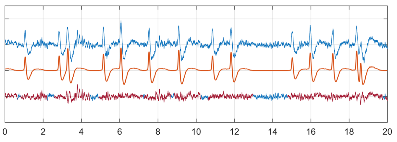 Graph of auditory signals