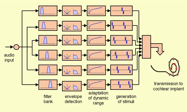 Block diagram of a cochlear implant system