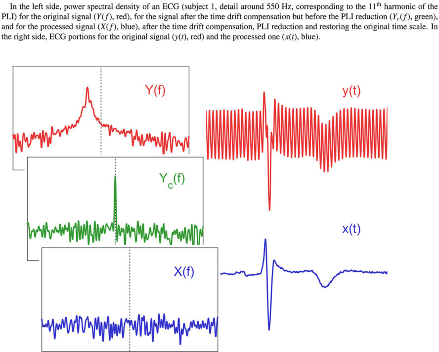 Publication of the algorithm for PLI reduction
